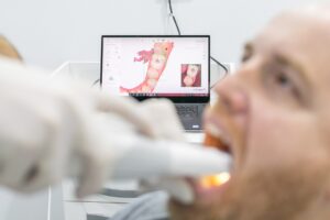 clínica dental en Burjassot - 3d
