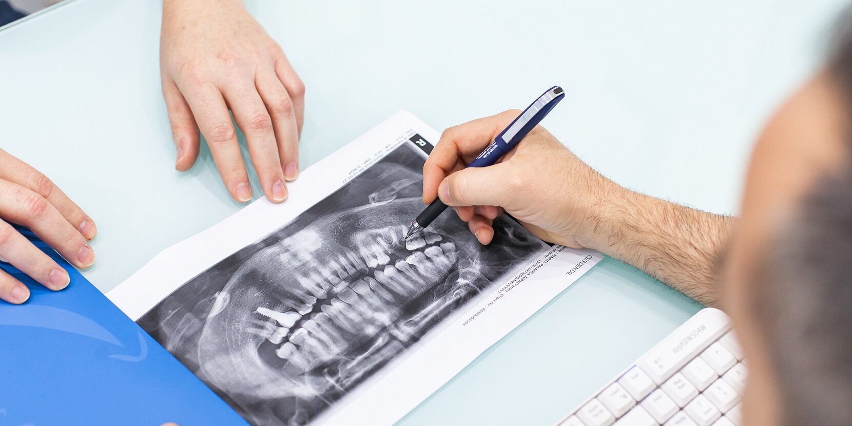 dentista en Burjassot - radiografias