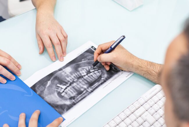 dentista en Burjassot - radiografias