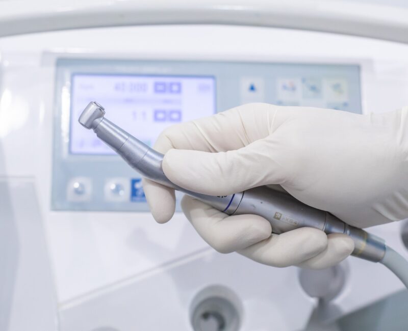 dentista en Burjassot - limpieza