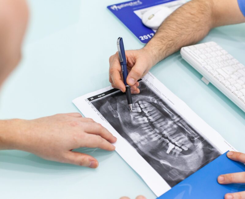 dentista en Burjassot - manos