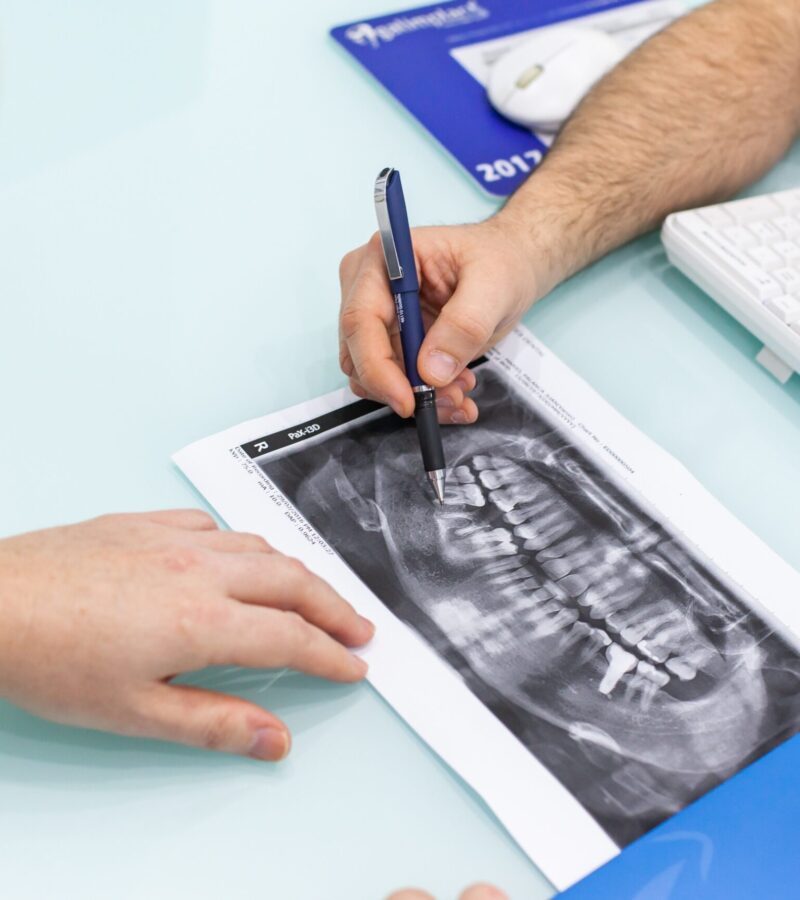 dentista en Burjassot - manos