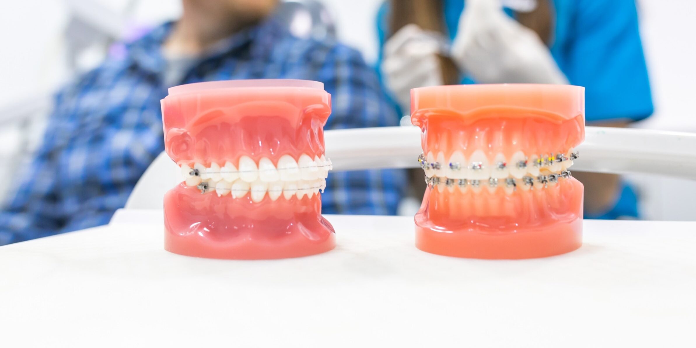 ortodoncia en Burjassot - modelos dentales