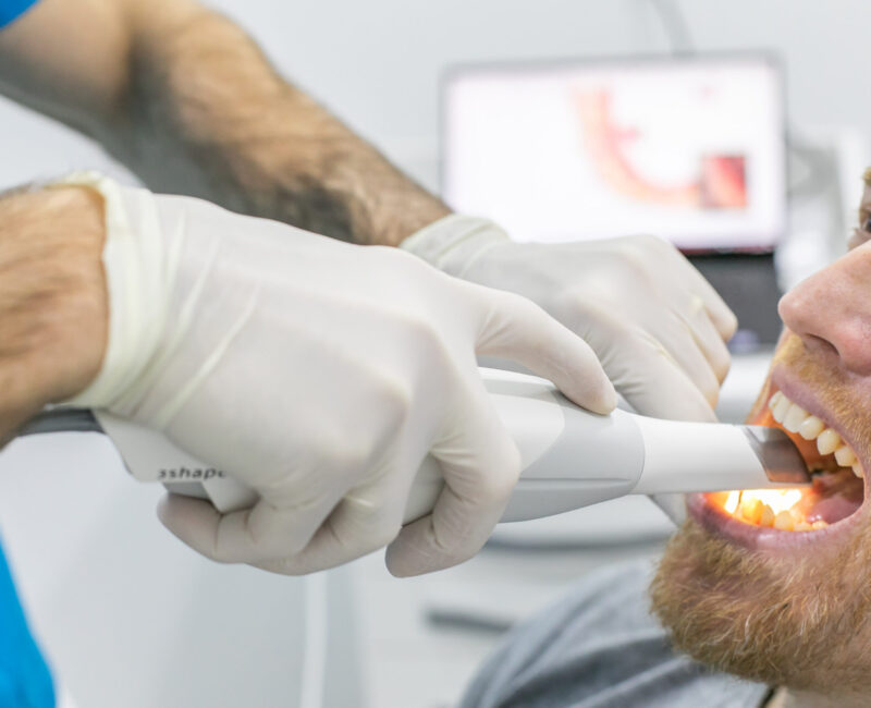 clínicas dentales en Burjassot - escaner