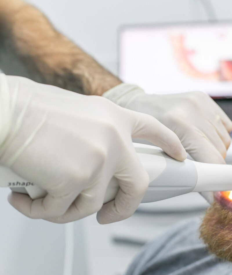 clínicas dentales en Burjassot - escaner