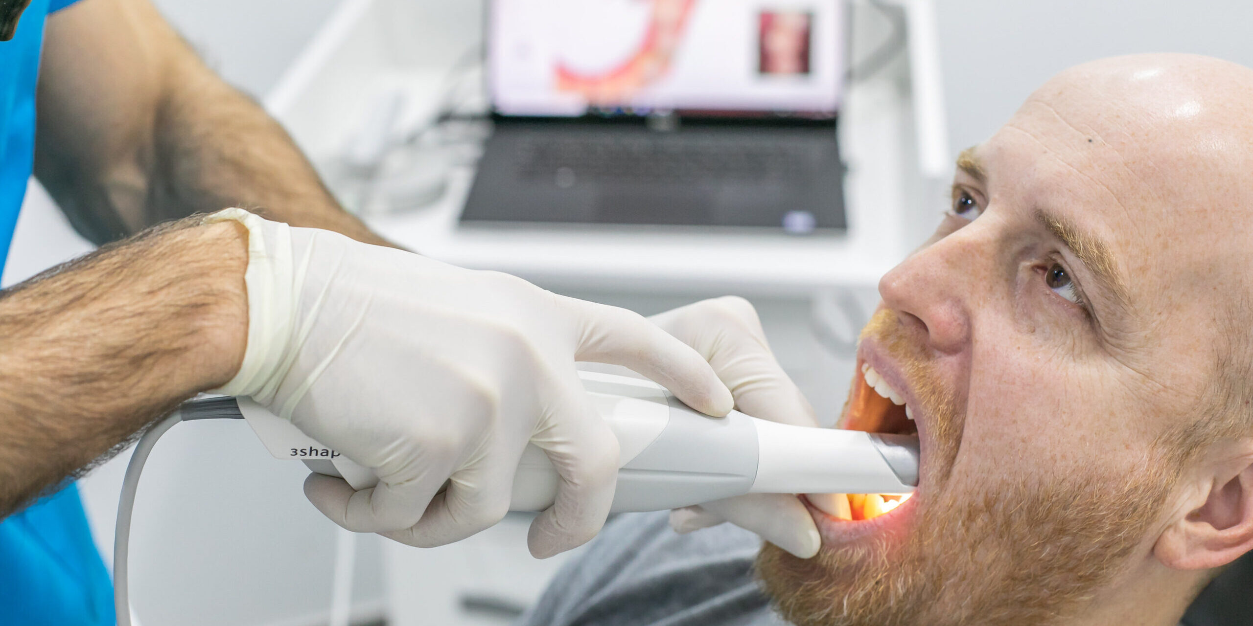 dentistas en Burjassot - scaner