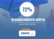Oferta de blanqueamiento dental - Burjassot
