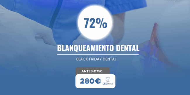 Oferta de blanqueamiento dental - Burjassot