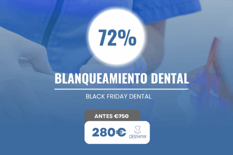Oferta de blanqueamiento dental - Burjassot