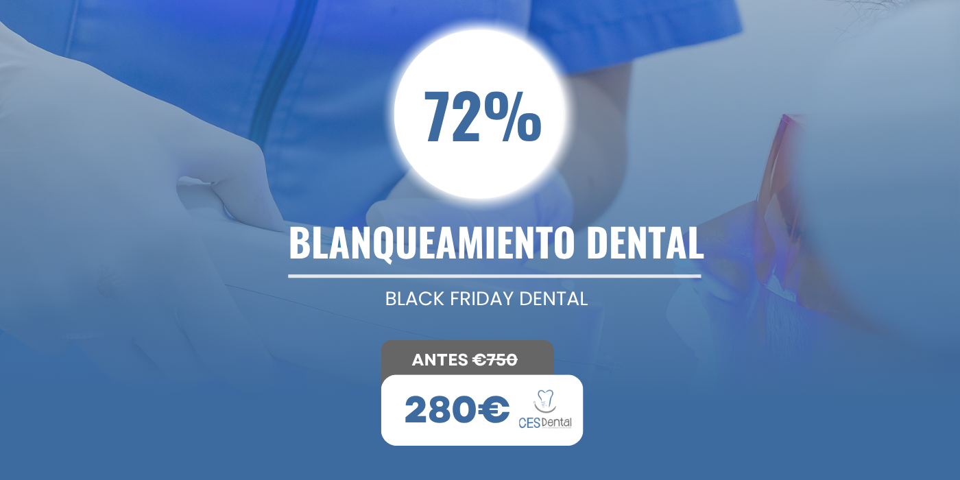 Oferta de blanqueamiento dental – Burjassot Oferta de blanqueamiento dental - Burjassot