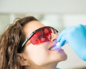 Blanqueamiento dental en Burjassot - Lentes