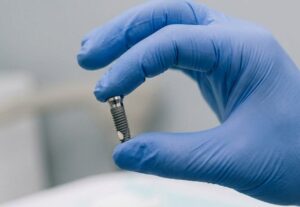 Implante dental inmediato en Burjassot - Tornillo