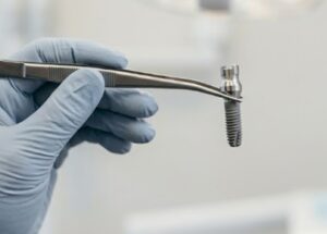 Implantes dentales en Burjassot - Metal