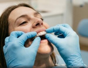 Ortodoncia invisalign en Burjassot - Retenedores