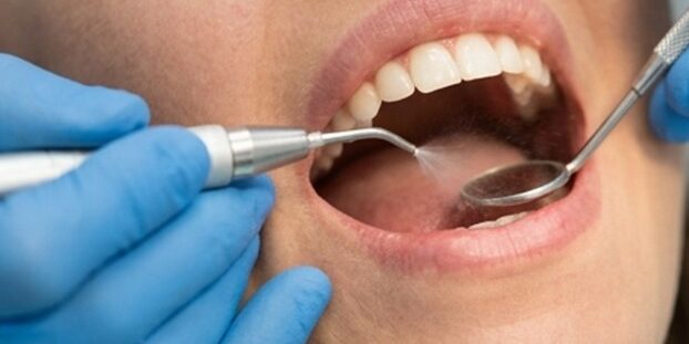 Dentista en Burjassot – Agua Dentista en Burjassot - Agua