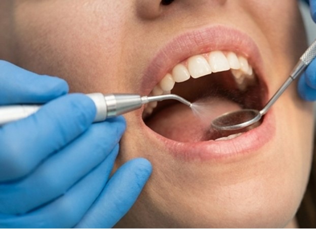 Dentista en Burjassot - Agua