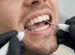 Clínica dental cerca de Burjassot - Instrumentos