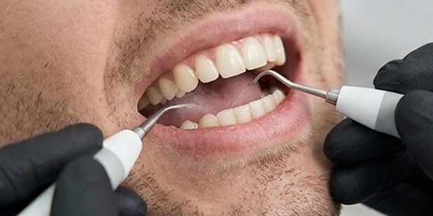 Clínica dental cerca de Burjassot - Instrumentos