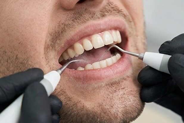 Clínica dental cerca de Burjassot - Instrumentos